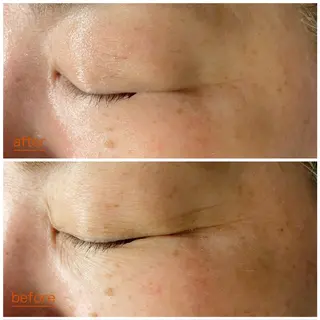 leolo 武蔵浦和 店長瀧澤のエステ・リラクイメージ