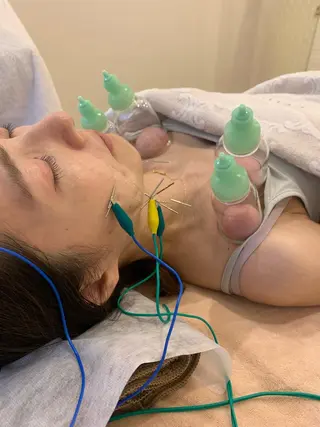 新宿hari-me所属・美容鍼hari-me 新宿のエステ・リラクイメージ