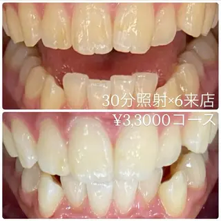 PLATINUM Beauty 横浜店所属・ホワイトニングルーム 横浜店のその他イメージ