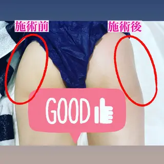 脱毛・エステサロン LuLuNのエステ・リラクイメージ