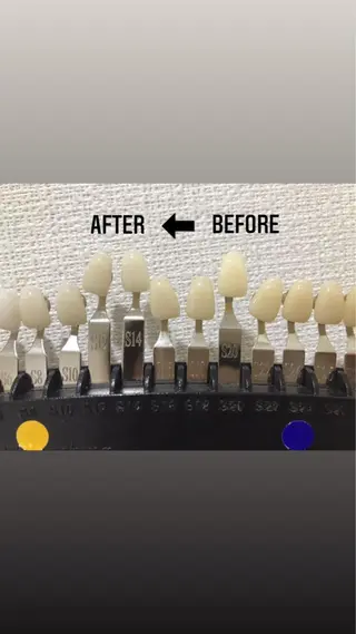 M渋谷店所属・Ｍ渋谷 ホワイトニングのエステ・リラクイメージ