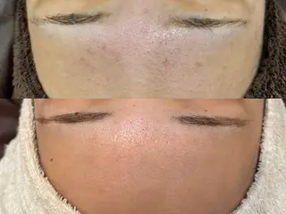 Nicore所属・Nicore NATSUKIのエステ・リラクイメージ