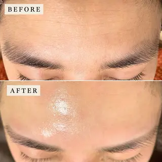 【産毛・眉毛ケア＆肌質改善サロン】＊BiBi＊beautysalon所属・眉･産毛専門BiBi 糸脱毛スレッティングのエステ・リラクイメージ