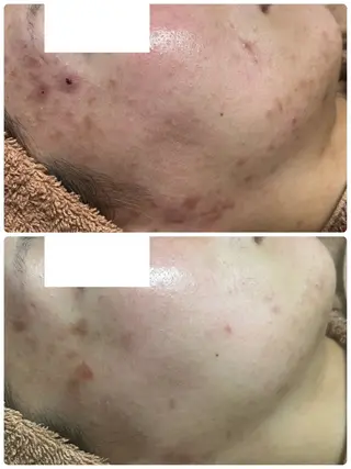 beautysalon  LINO所属・平日限定！お得！ 全メニュ¥5,500のエステ・リラクイメージ