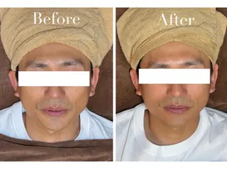 Avenir Brillant所属・松田 紗季のエステ・リラクイメージ