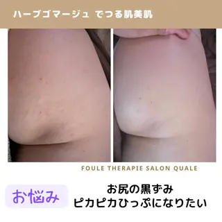 【足圧】鬼👹リンパ 身体整うサロンのエステ・リラクイメージ