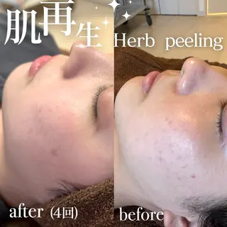 美肌salon GRAN CUORE所属・Natsuki🌙 GRAN CUOREのエステ・リラクイメージ