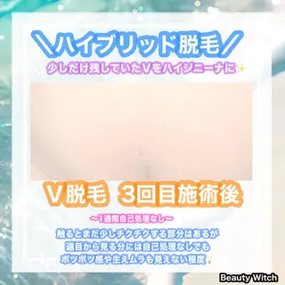 痩身/脱毛/ネイル HARUKAのエステ・リラクイメージ