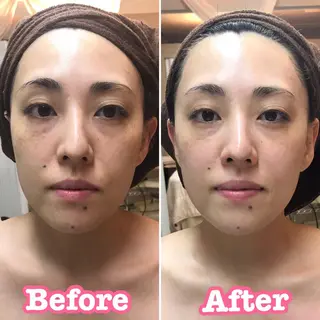 🥀エステティック レイビス横浜 永🥀のエステ・リラクイメージ