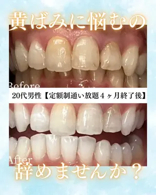 メンズ キッズ ホワイトニング専門店 WHITE天神店のエステ・リラクイメージ