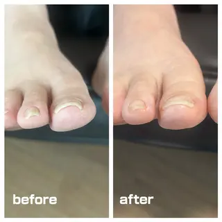 巻き爪フットケアサロンKotori所属・フットケアサロン Kotoriのその他イメージ