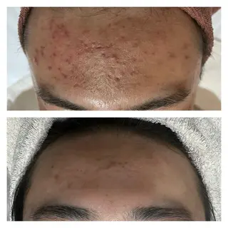 Lussera(ルセラ)所属・肌質を変えて すっぴん肌に✨のその他イメージ