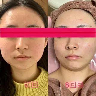 透明感の肌Lino malieのエステ・リラクイメージ