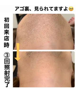 メンズ メンズ脱毛サロン Le falcoのエステ・リラクイメージ