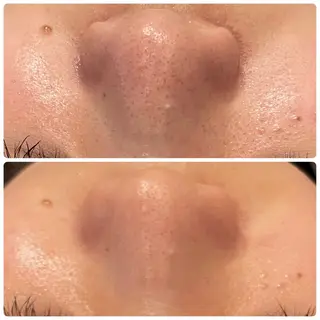 yellow.所属・yellow💛【 脱毛&フェイシャル】のエステ・リラクイメージ