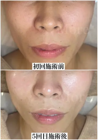 salon de beauté More所属・More 大阪福島区 毛穴・肌質改善のエステ・リラクイメージ