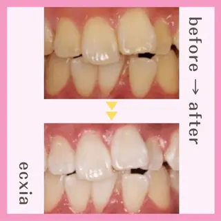 ホワイトニング/脱毛 専門店エクシア岡崎店のその他イメージ