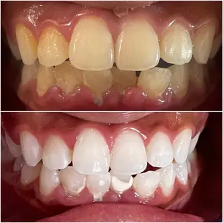 五十嵐 蓮のその他イメージ