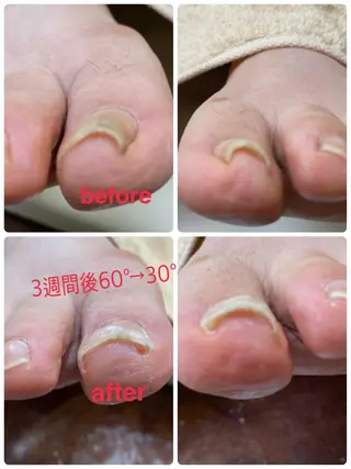 ネイル 巻き爪&フットケア レクーラのその他イメージ