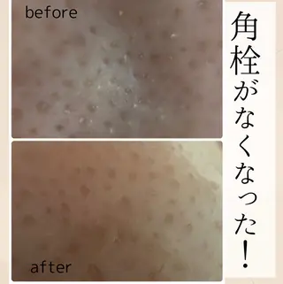 小顔・毛穴・たるみ ネイル　似内真樹のエステ・リラクイメージ