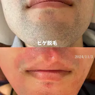 【LEPUS】レプス nishimoriのエステ・リラクイメージ