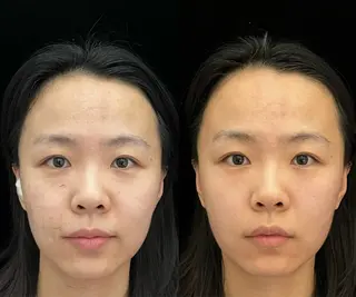 ネイル aliaハイフ&水光ジェットサロン所属・aliaハーブ水光店 エステティシャン募集のエステ・リラクイメージ