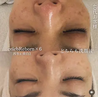 【福岡市西区 エステ】 GRANVIR(グランヴィール)所属・GRANVIR グランヴィールのエステ・リラクイメージ