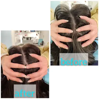 小顔美容鍼専門サロン 渋谷YZのエステ・リラクイメージ