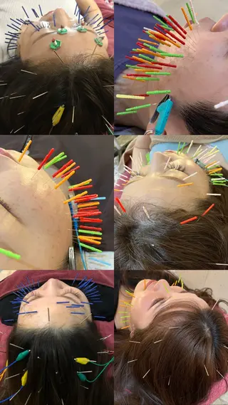 美容鍼灸女性専用 りんご鍼灸治療院のエステ・リラクイメージ