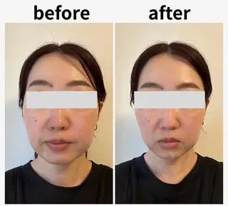 脱毛サロンWillow所属・脱毛サロン Willow/宮島のエステ・リラクイメージ