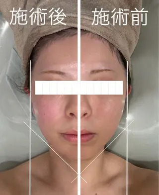 小澤 joieange京橋のエステ・リラクイメージ