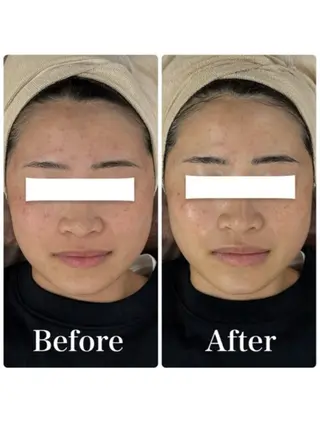 メンズ 小顔フェイシャル 専門店Soarのエステ・リラクイメージ