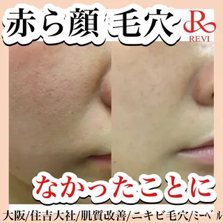 salon  mebell所属・肌管理専門店 mebell天王寺店のエステ・リラクイメージ