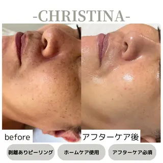 肌質改善|天王寺 For...はるかのエステ・リラクイメージ