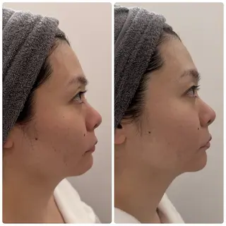 アピタ千代田橋店 POLA THE BEAUTY所属・エステ ツヤ肌 マッサージ POLAのその他イメージ