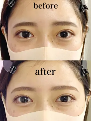 white eye 西宮北口店所属・WHITE EYE 🦋松島のエステ・リラクイメージ