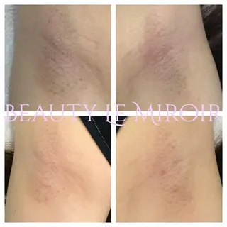 ビューティー ミロワールのエステ・リラクイメージ