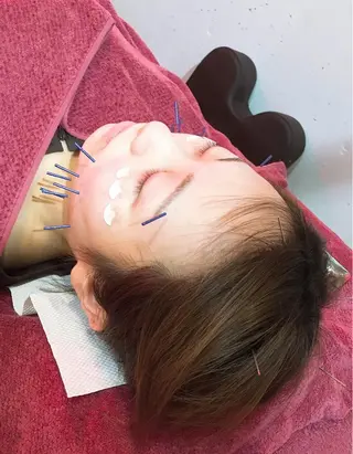 美容鍼灸女性専用 りんご鍼灸治療院のエステ・リラクイメージ