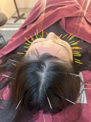 美容鍼灸女性専用 りんご鍼灸治療院のエステ・リラクイメージ