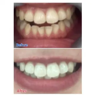 M渋谷店所属・Ｍ渋谷 ホワイトニングのエステ・リラクイメージ