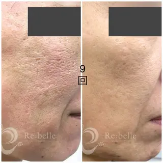 MAMA +beautyのエステ・リラクイメージ