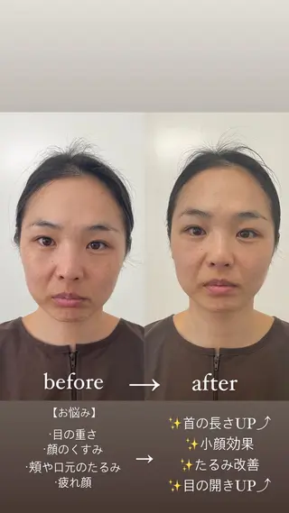 美容鍼・鍼灸専門❤✨ 近藤めぐみのエステ・リラクイメージ