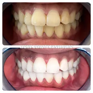 ライトビューティー 錦糸町店のエステ・リラクイメージ