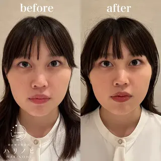 美容鍼灸整体院 ハリノヒ大阪院のエステ・リラクイメージ