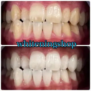 メンズ ホワイトニング ショップ川越店のエステ・リラクイメージ