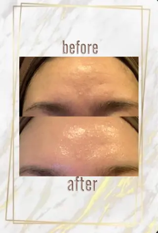 ハーブピーリング特選 認定rebirthのエステ・リラクイメージ