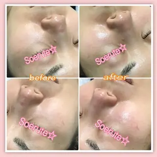 Soerute☆ ソエルテ 井上みえのエステ・リラクイメージ