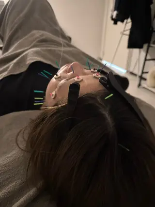 美容鍼×小顔矯正 ×美容整体　浜川泰仁のエステ・リラクイメージ