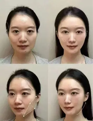 マツエク・マツパ aliaハイフ&水光ジェットサロン所属・aliaハーブ水光店 エステティシャン募集のエステ・リラクイメージ