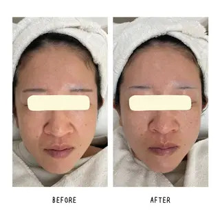 grow所属・Yoshino Erinaのエステ・リラクイメージ